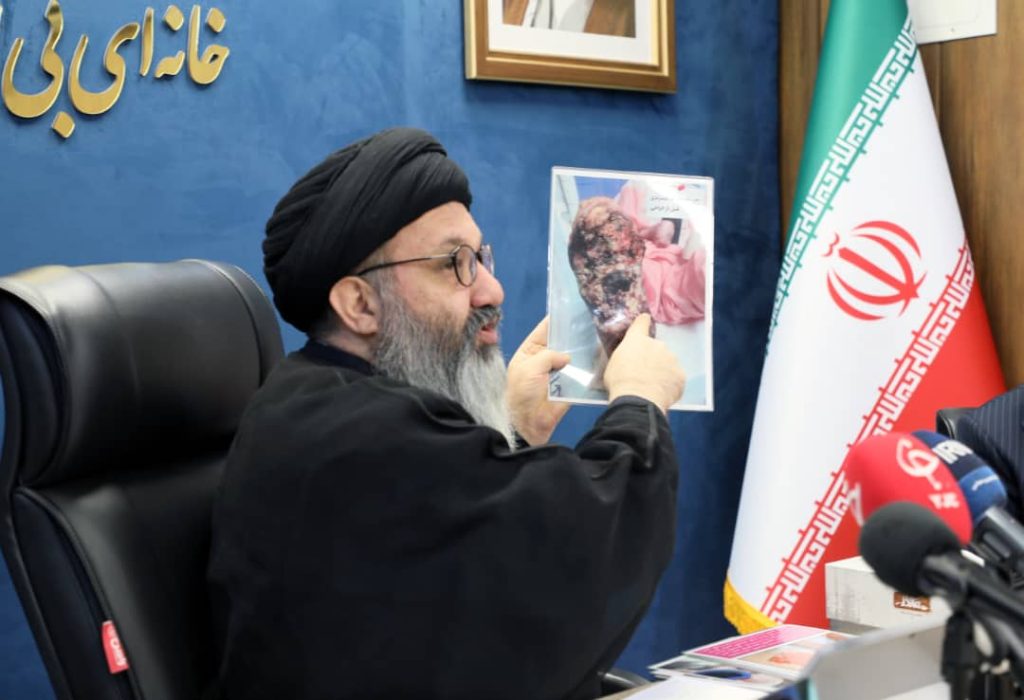 نشست خبری خانه ای بی