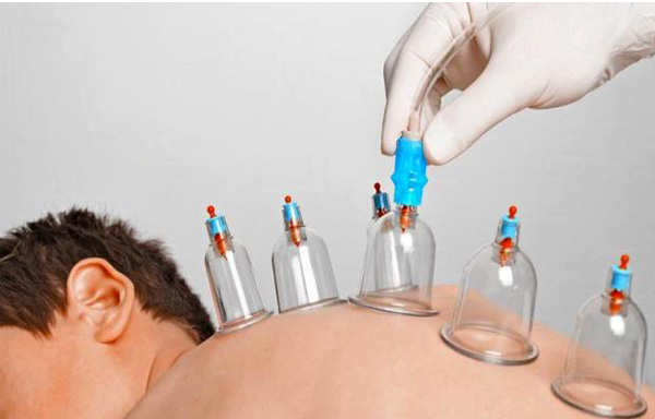 حجامت در ماه رمضان ضرر